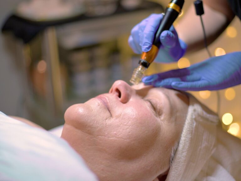 02 Collagen Induction Therapy.00_00_31_09.Still002